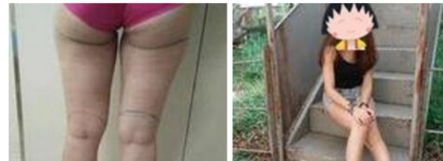 整形医生冯斌口碑如何-技术水平-案例分享-项目价格-北京东方和谐