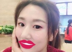 侯典举修复能力真是让我刮目相看，同时走出了失败的阴影