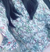 在东莞瑞芙臣做的假体隆胸升级了我的事业线