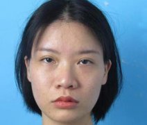 真的没有想到，在湖南长沙美莱医院做的隆鼻手术，让闺蜜如此羡慕