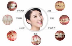 一身颜值全毁在了着牙齿上了，好在在成都博爱做完矫正，我也可以开心笑了