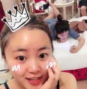 在北京博美做的双眼皮让我重生了，终于可以愉快的出门了