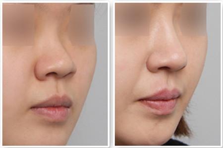 北京武警医院整形美容科口碑好吗