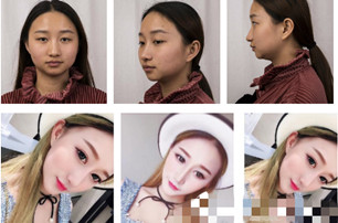 上海华美医疗美容医院怎么样