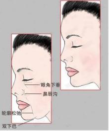 鹏爱医院的热玛吉真吗