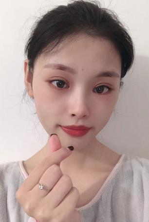 余东主任医师的个人简介-开眼角案例-手术风格-上海九院