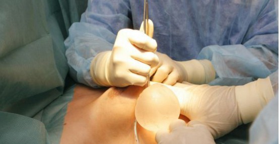 吴建明医生做隆胸手术技术好吗？案例果图分享