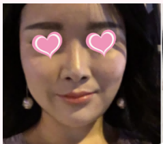 整形专家杨斌技术如何？整形专家杨斌案例分享