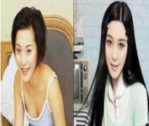 明星整容医院保密吗？我在北京八大处找到了李站强帮我做了鼻子