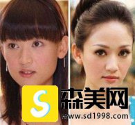 根据明星整容成功的案例的对比，我找到了重庆西南医院完成了鼻部手术