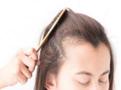 武汉恩吉娜的廖静医生的植发际线要多少?附植发案例和较新植发价目表