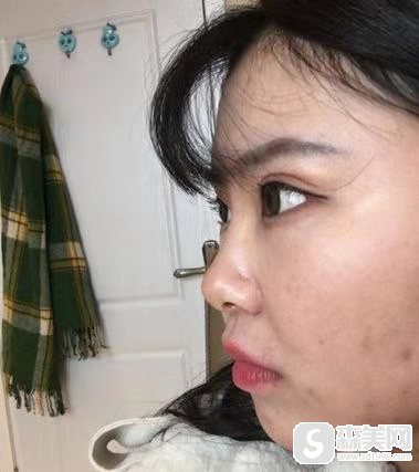 上海仁爱医院怎么样呢？项目推荐,案例分享