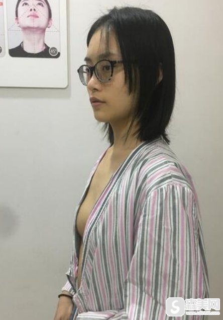 想成女神？请来沧州美神!美神医疗隆胸案例分享！附术后果图