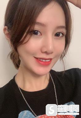 颧骨宽显得脸大怎么办？301医院颧骨案例恢复图