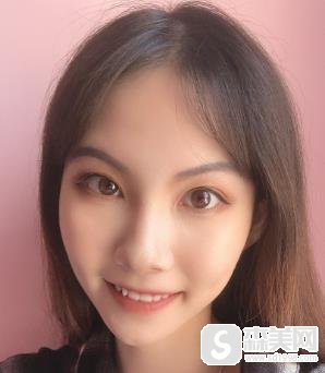 颧骨高太阳凹陷自己怎么改善？上海时光手术前后对比图