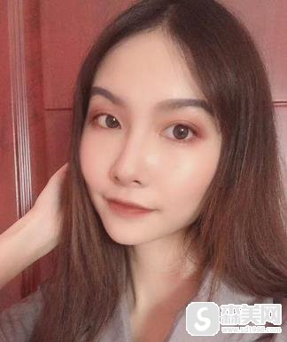 颧骨高太阳凹陷自己怎么改善？上海时光手术前后对比图