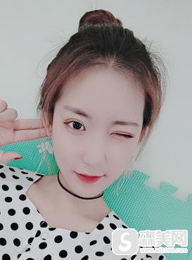 颧弓外扩怎样矫正？辽宁中医院手术前后对比图