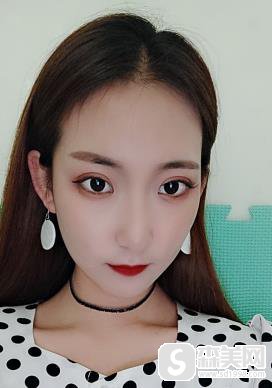 颧弓外扩怎样矫正？辽宁中医院手术前后对比图