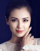 颧弓外扩的女明星有谁？上海九院给我拯救了我的轮廓