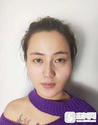 颧弓外扩的女明星有谁？上海九院给我拯救了我的轮廓