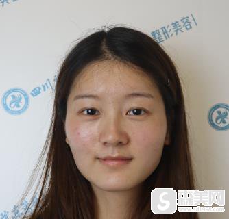 颧弓留白宽怎么改变？北京京民手术过程