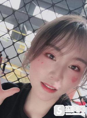 去痘微创案例，盛京医院整形科术后恢复对比