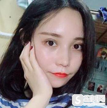 成都悦好整形眼部手术怎么样？开眼角前后对比