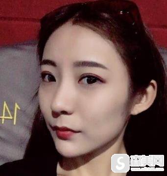 伊美尔整容医院好不好?附真实案例+果对比图