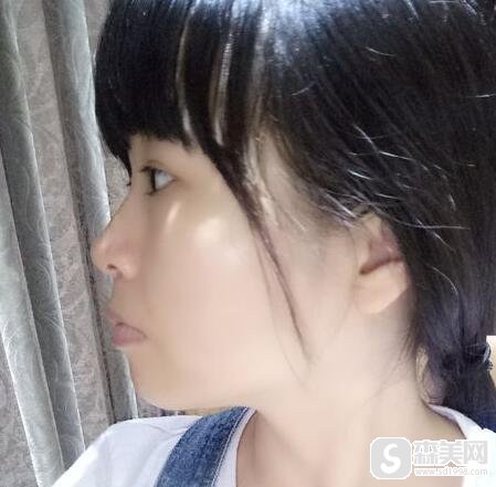 赛德阳光口腔上海南京西路门诊部进行的牙齿矫正果怎么样?