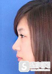 重庆真伊医疗美容医院怎么样？口碑情况+专家介绍+隆鼻案例分享！