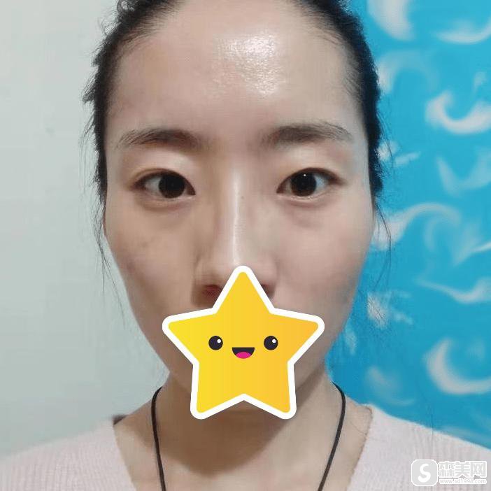 同济大学附属杨浦医院整形外科怎么样？口碑情况/案例展示/医生团队介绍