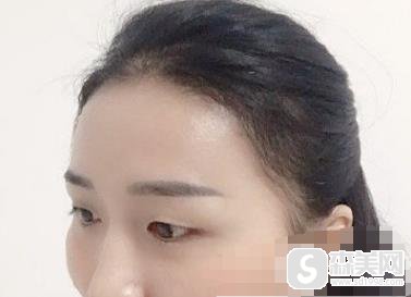 上海第九人民医院价目表2020，植发价格，内含植发案例果图