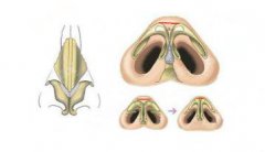 做鼻子整形多少钱？隆鼻手术有什么方法？