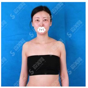 上海首尔丽格的专家医生怎么样？磨骨医生介绍+案例果图展示