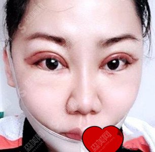 上海首尔丽格医生专家怎么样？洪性范医生的技术特色+案例果图分享