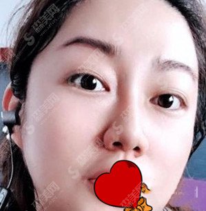 上海首尔丽格医生专家怎么样？洪性范医生的技术特色+案例果图分享