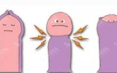 切包皮的价格是多少？附切包皮的价格一栏及切包皮的成功案例分享