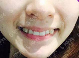 康贝佳口腔医院价格表2021，内含隐形矫正果图公布