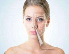 长沙美莱和亚韩哪个好？实力大PK＋案例分享