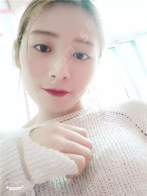 宜宾口腔医院佘晓晴医生种植牙手术技术好吗?宜宾口腔医院种植牙果案例附真实照片