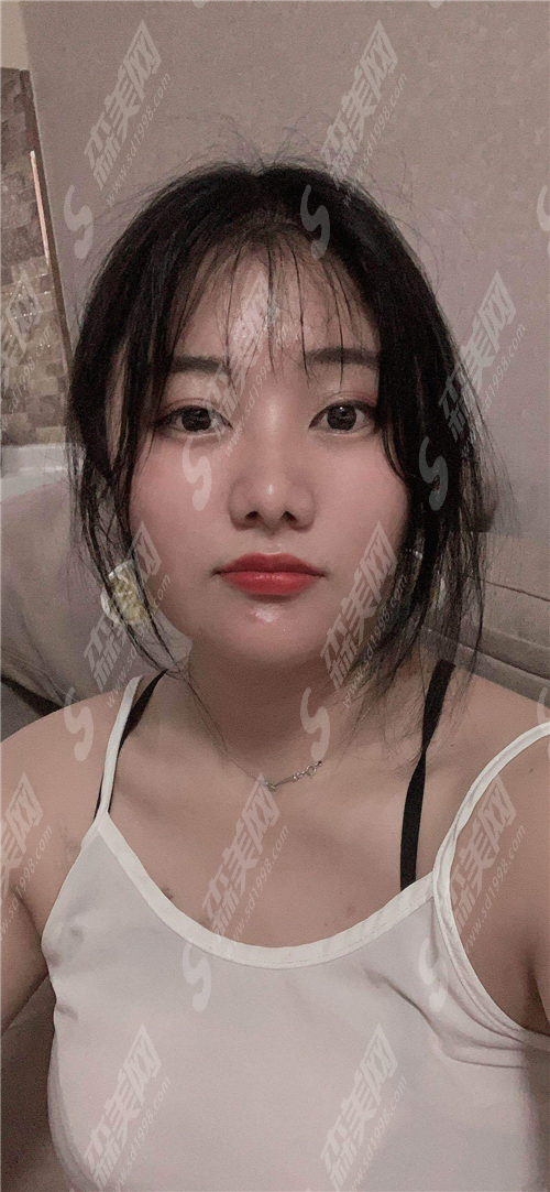 热玛吉多久做一次合适?果能够维持多久?