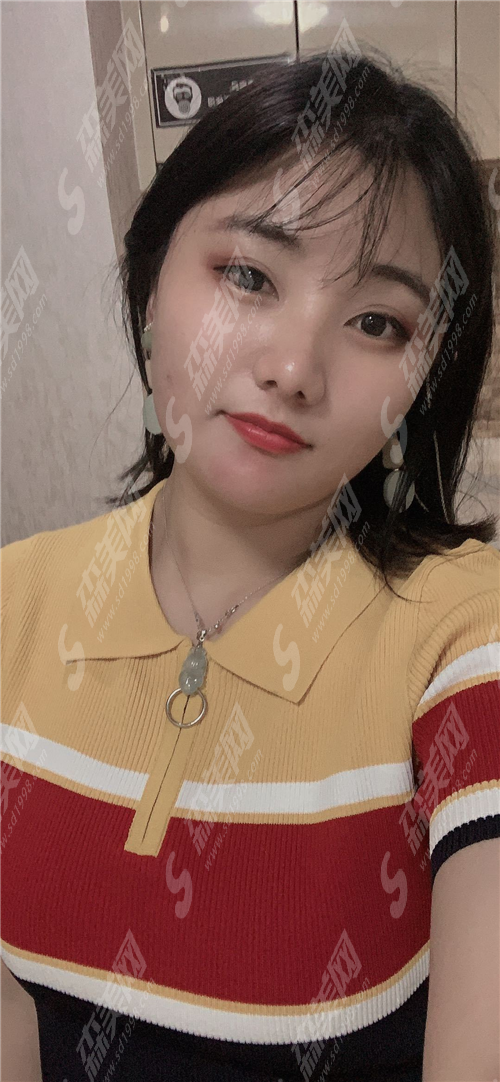 热玛吉多久做一次合适?果能够维持多久?