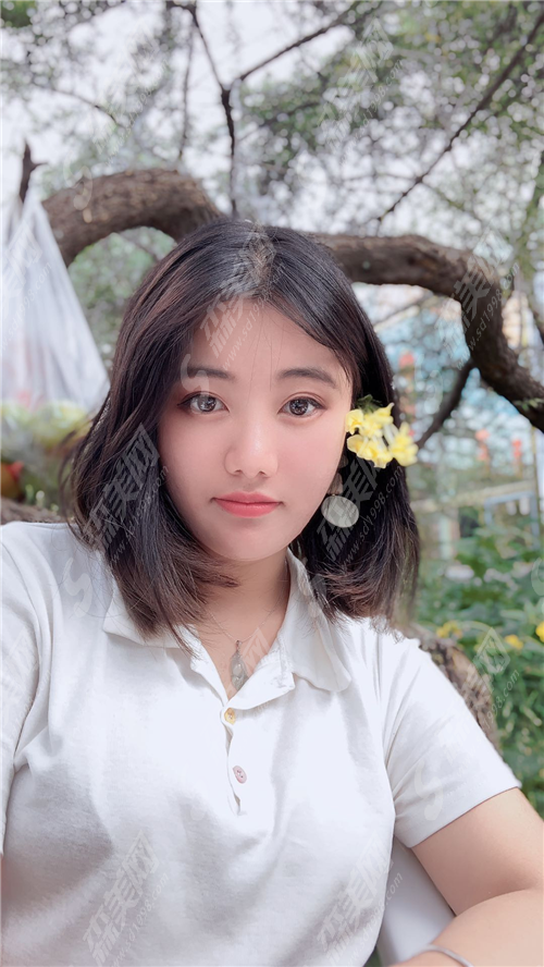 热玛吉多久做一次合适?果能够维持多久?