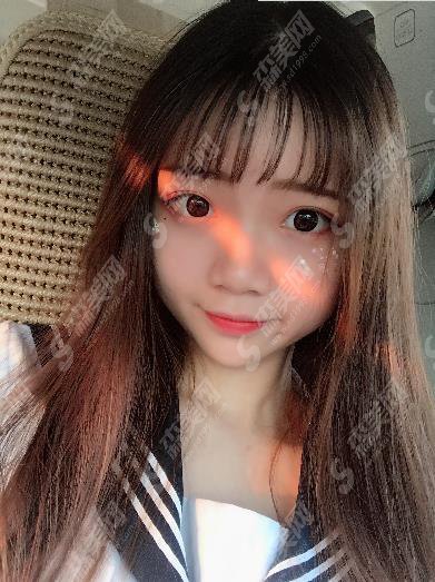 爱容整形医院面部填充多少钱？价格查询及面部填充案例图片欣赏