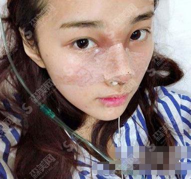 唐山金荣整形美容医院代金荣隆鼻技术好吗？专家个人简介、案例参考