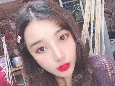 唐山金荣整形美容医院代金荣隆鼻技术好吗？专家个人简介、案例参考