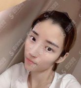 修志夫整形美容医院玻尿酸隆鼻价格，价格查询及隆鼻案例图片欣赏