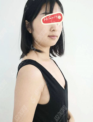 南方医院整形科哪个医生好？自体脂肪隆胸果怎么样？隆胸的术后恢复对比图分享！