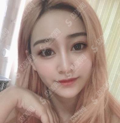 徐州四院整牙做的好吗？通过牙齿矫正让自我拥有好的状态开森！