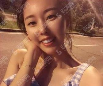 滁州市第一人民医院口腔科种植案例，价格表千万别错过！